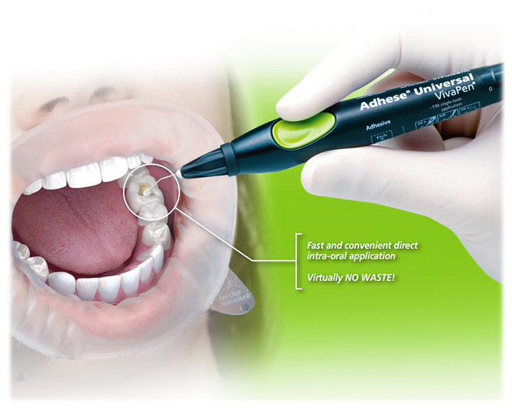 AdheSE Universal - Light-curing Dental Adhesive - VivaPen - Click Image to Close