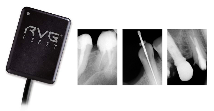 RVG First - Intraoral Sensor - Size 1 - Click Image to Close