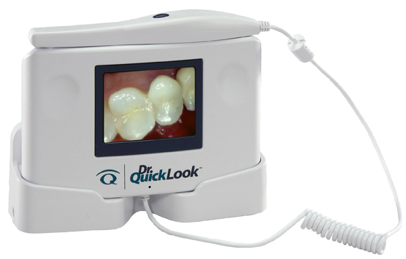 DrQuickLook - Visor Dental Intraoral